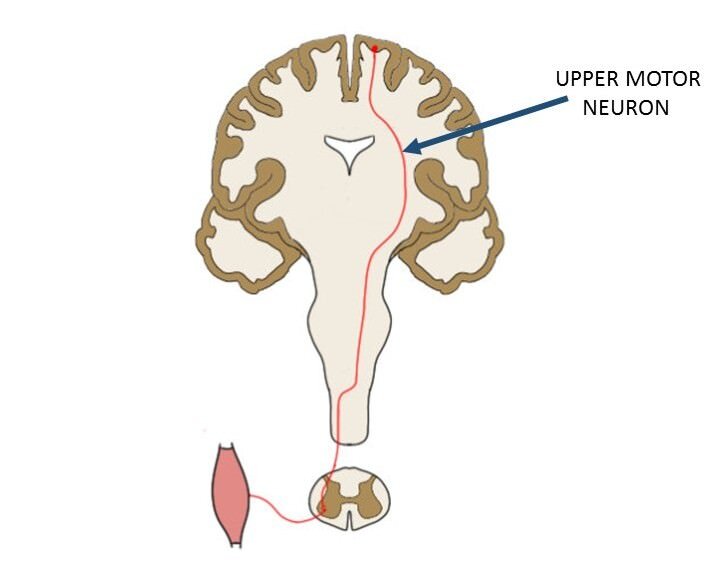upper motor neuron.