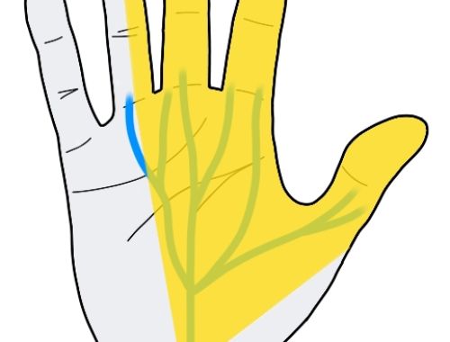 2-Minute Neuroscience: Carpal Tunnel Syndrome