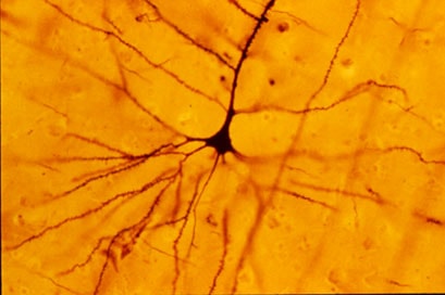 a pyramidal neuron stained with a golgi stain