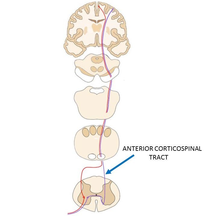THE ANTERIOR CORTICOSPINAL TRACT IS REPRESENTED BY THE PURPLE LINE THAT RUNS FROM THE MOTOR CORTEX DOWN TO THE SPINAL CORD.