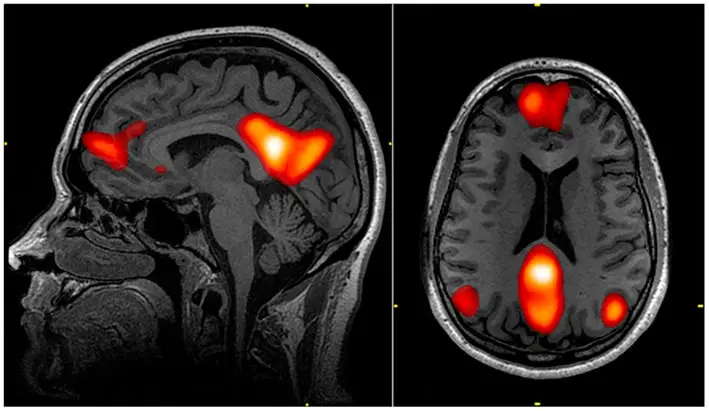 hippocampus anatomy model network