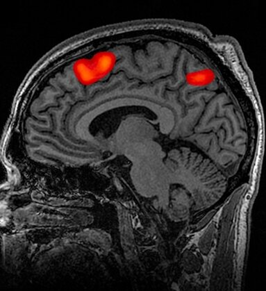 fMRI of the human brain