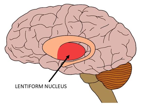 THE LENTIFORM NUCLEUS IS COLORED RED IN THIS IMAGE.
