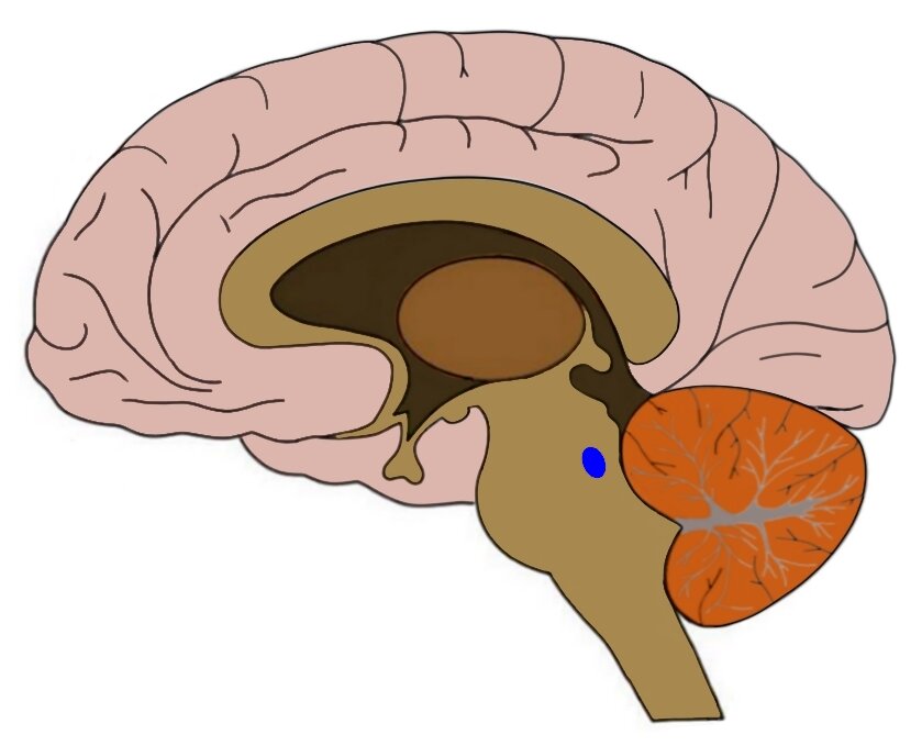Image of brain stem with blue dot showing locus coeruleus