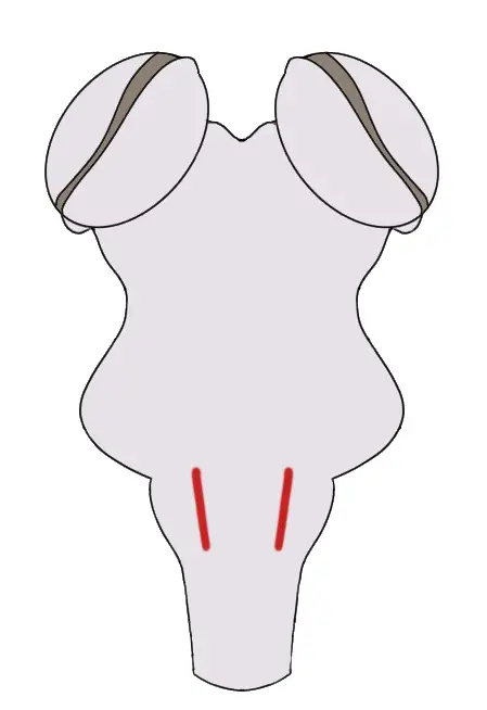 VIEW OF THE POSTERIOR BRAINSTEM WITH THE NUCLEI OF THE SOLITARY TRACT IN RED.