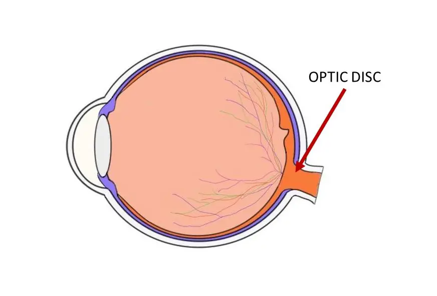 optic disc