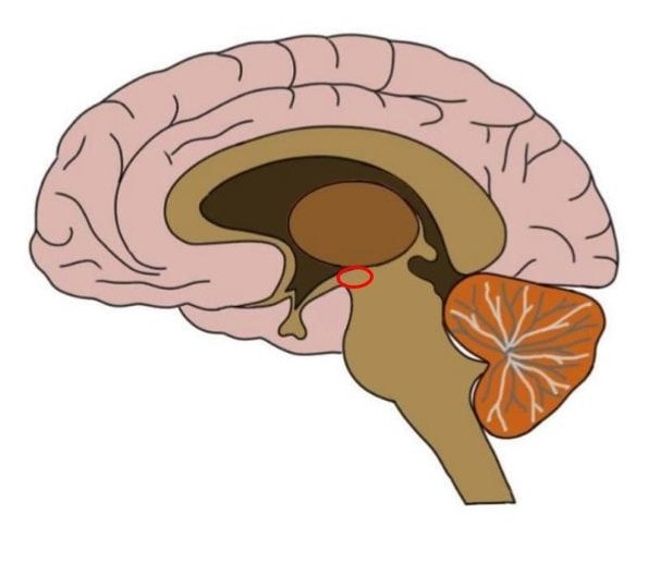 REGION OF THE SUBTHALAMUS CIRCLED IN RED.
