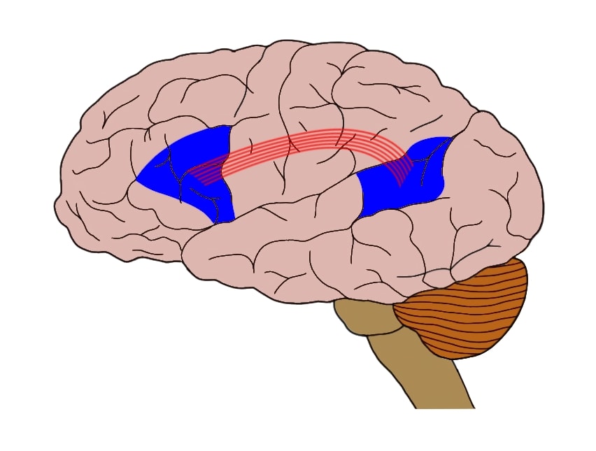 IN THIS IMAGE, BROCA’S AREA IS REPRESENTED BY THE BLUE REGION CLOSER TO THE FRONT OF THE BRAIN (ON THE LEFT), WHILE WERNICKE’S AREA IS REPRESENTED BY THE BLUE REGION CLOSER TO THE BACK OF THE BRAIN (ON THE RIGHT). THE RED LINES REPRESENT THE ARCUATE FASCICULUS, CONNECTING THE TWO REGIONS.
