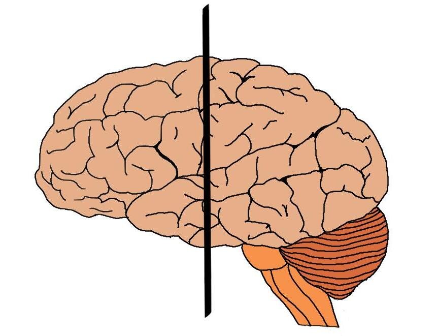 The black line above represents a frontal plane.